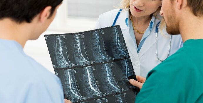 Radiografia della colonna vertebrale come metodo per diagnosticare l'osteocondrosi