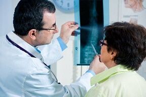 Diagnostica a raggi X dell'osteocondrosi cervicale