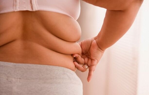 sovrappeso, causa dell'osteocondrosi cervicale nelle donne sotto i 40 anni